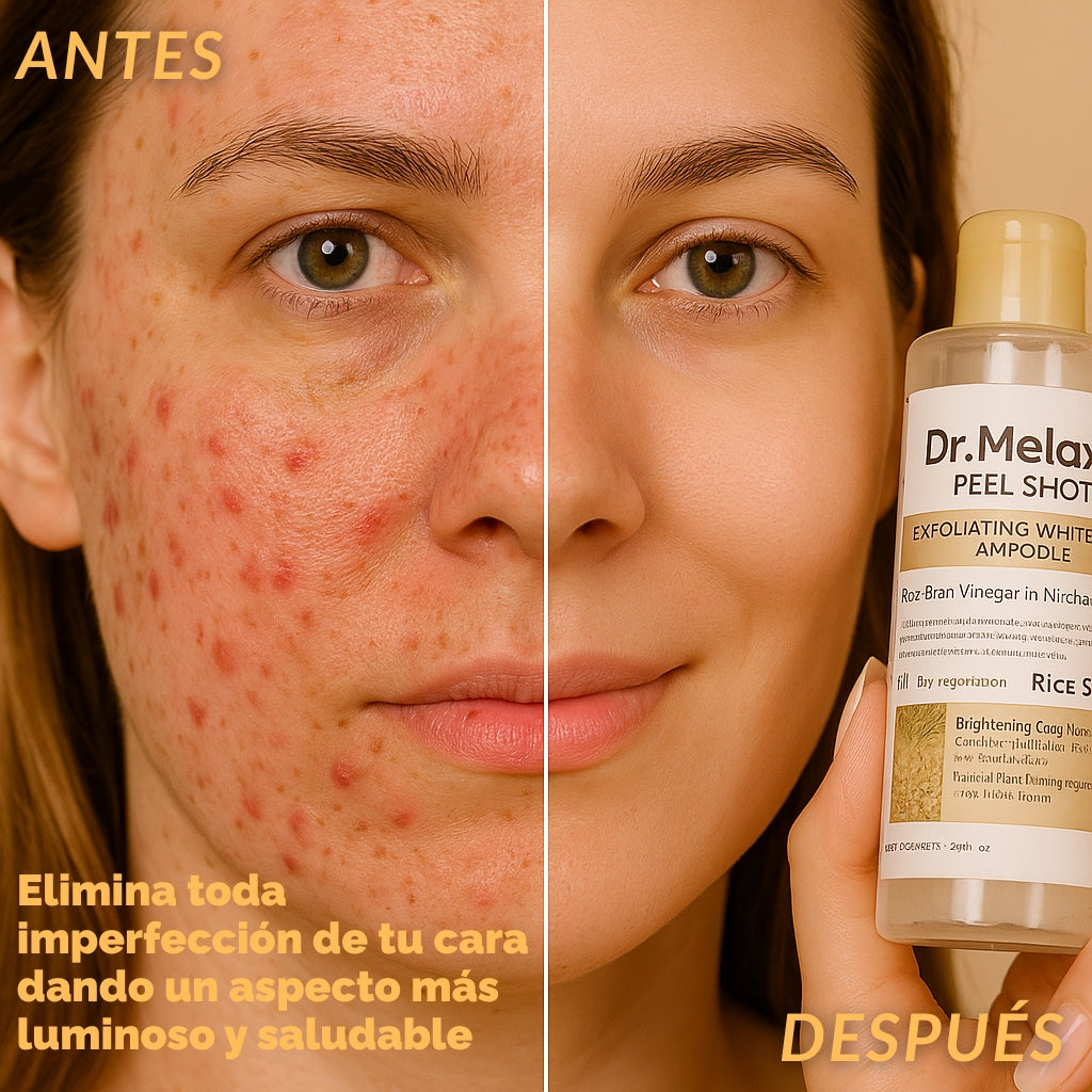 Exfoliante Anti-Imperfecciones Dr.Melaxín
