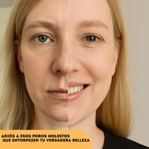 Exfoliante Anti-Imperfecciones Dr.Melaxín